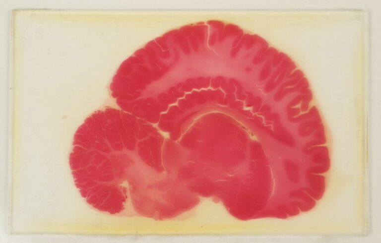 Hersencoupes gemaakt met het reuzenmicrotoom van Jelgersma, 1900-1925, foto: Rijksmuseum Boerhaave